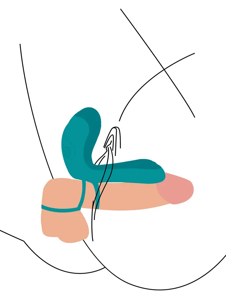 Couples Vibrator Ring - Vibrierender Penisring 2
